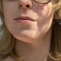 Acvalens Naken