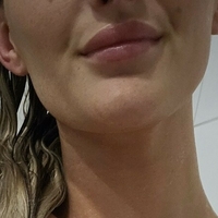 Marie Müller Naken